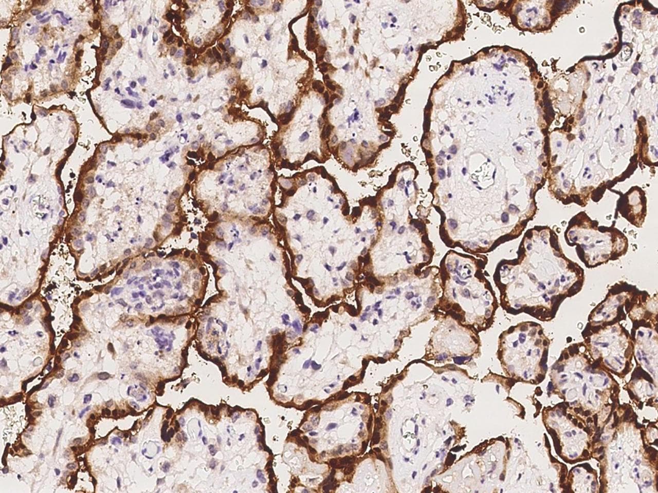 CLIC3 Antibody