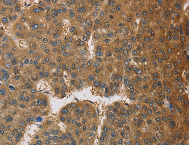 TRAIL-R4 / DCR2 Antibody