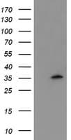 Monoclonal Mouse anti-Human MLF1 Antibody (clone OTI3F11, IHC, WB)