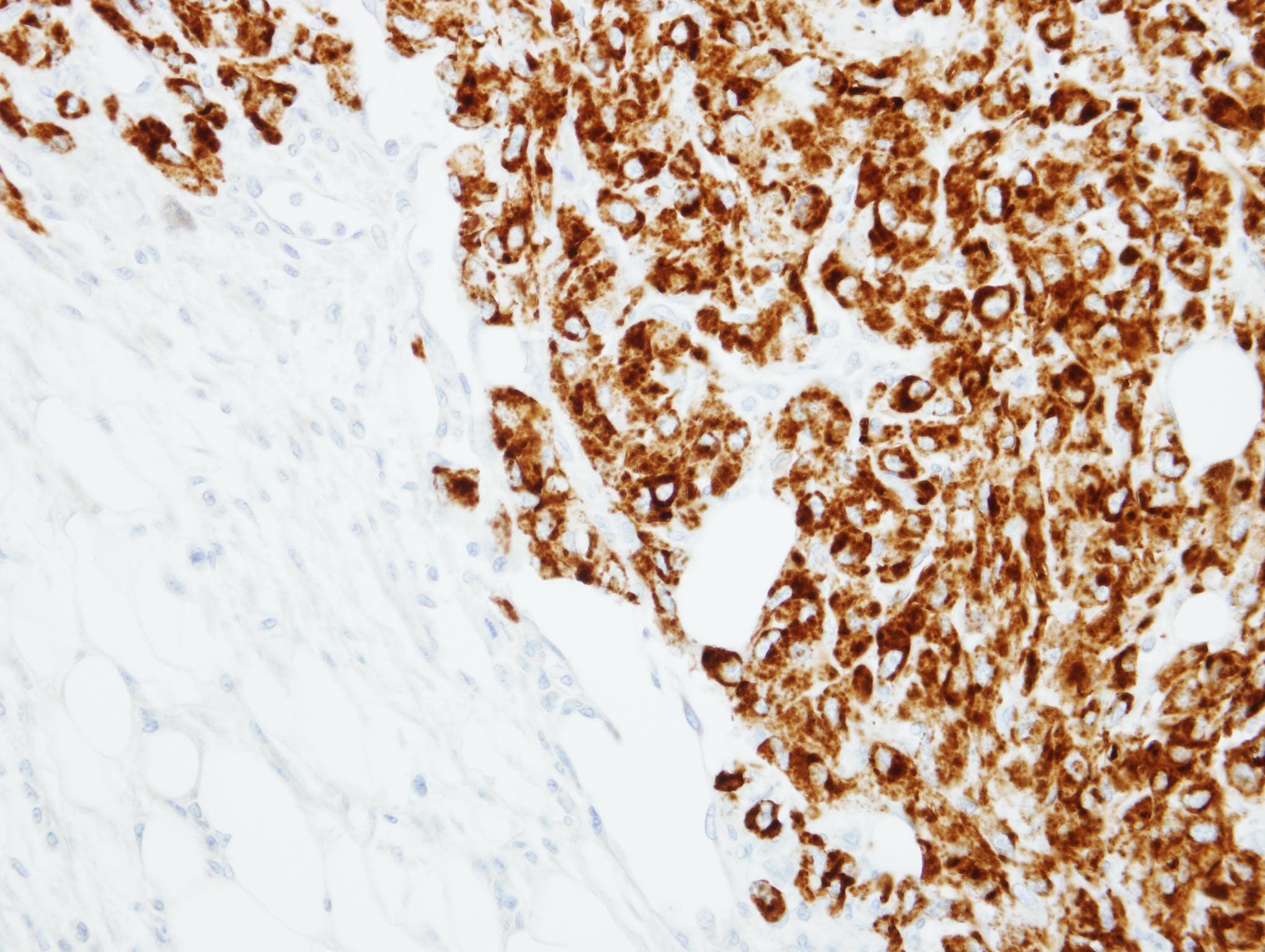 TNFSF11 / RANKL / TRANCE Antibody (aa253-317)