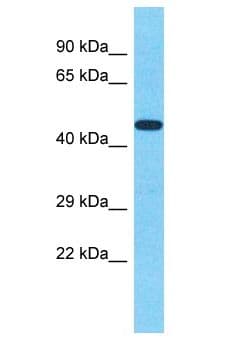 GSS / Glutathione Synthetase Antibody (aa345-394)