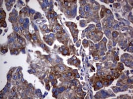 PIK3C2A Antibody (aa230-560, clone OTI2E4)