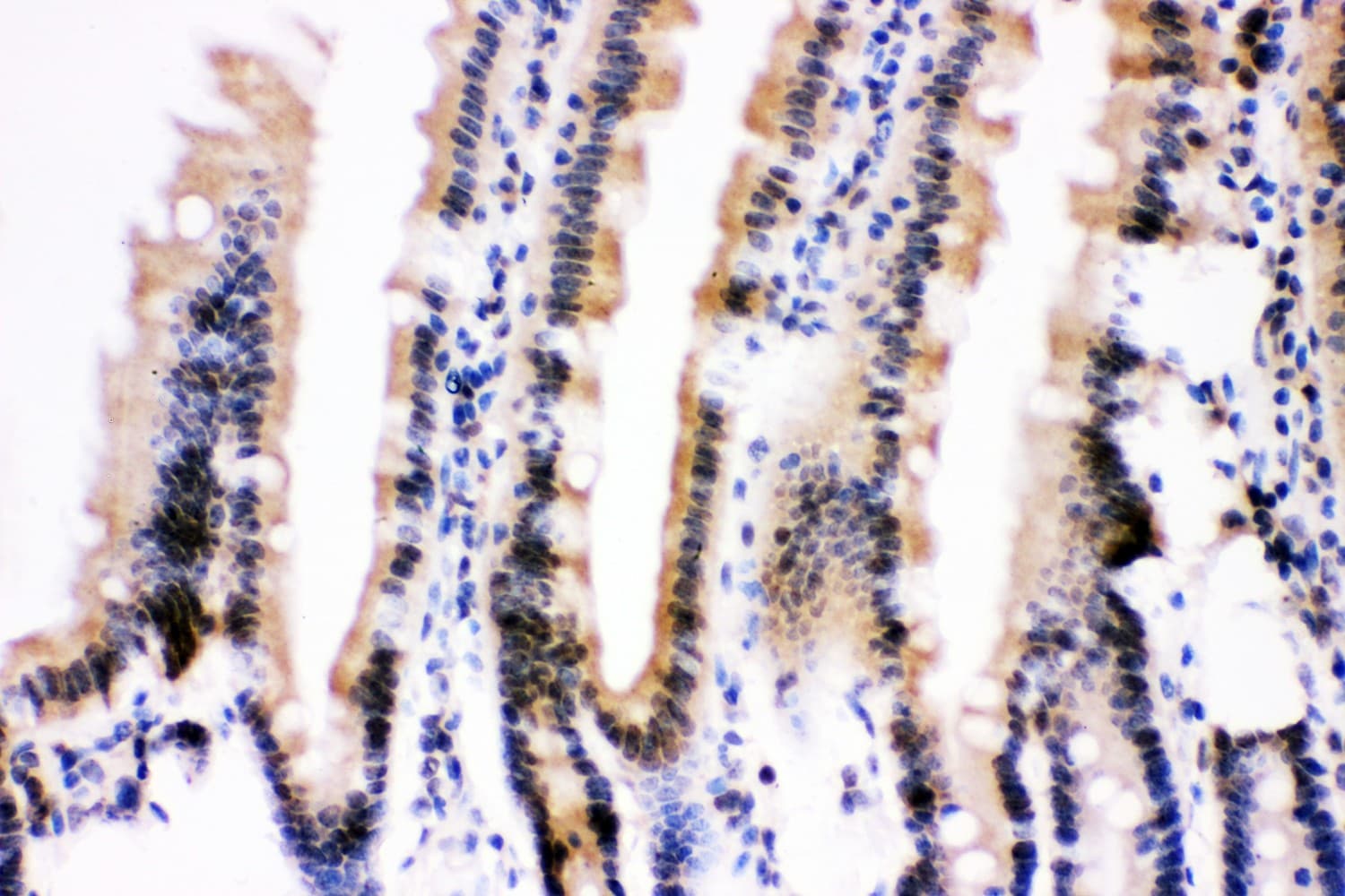 Polyclonal Rabbit anti-Human UBB / Ubiquitin B Antibody (aa77-152, IHC, WB)