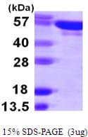 Human YARS / Tyrosyl-tRNA Synthetase Protein (Recombinant His)
