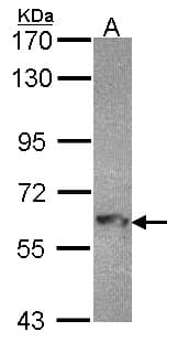 Polyclonal Rabbit anti-Human MTMR9 Antibody (aa487-549, IHC, WB)