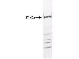 IHC-plus™ IKBKB / IKK2 / IKK Beta Antibody (C-Terminus)