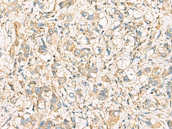 Polyclonal Rabbit anti-Human IDS / Iduronate 2 Sulfatase Antibody (IHC)