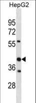 STOML2 Antibody (aa161-189)