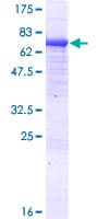 Human KLHL29 Protein (Recombinant GST)