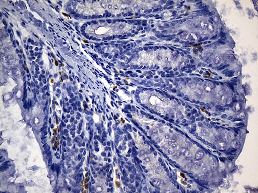 CD74 / CLIP Antibody (clone UMAB231)