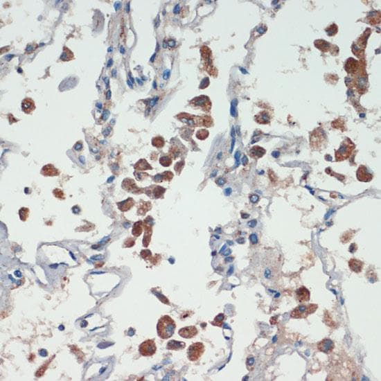 APC Antibody