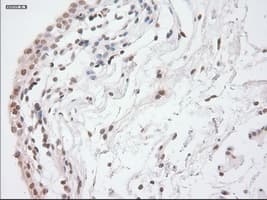 GAD1 / GAD67 Antibody (clone OTI3H2)