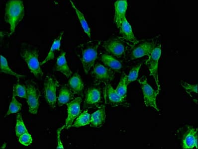 Polyclonal Rabbit anti-Human RARS Antibody