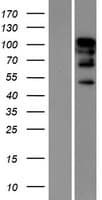 RBM26 / SE70 Protein (Over-Expression Lysate Myc-DDK (Flag))