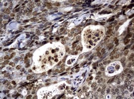 PCNA Antibody (clone OTI6A10)
