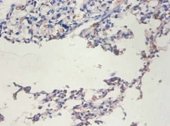 TERT / Telomerase Antibody