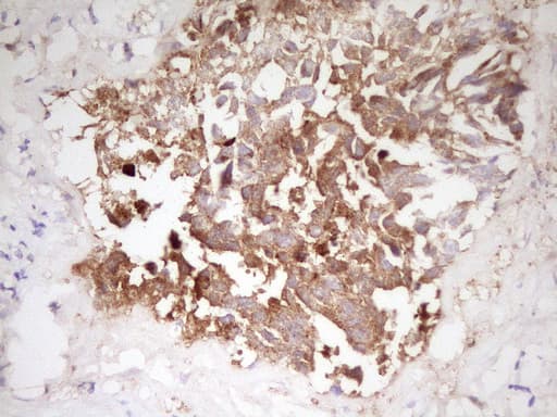 APOE / Apolipoprotein E Antibody (clone OTI1D6)