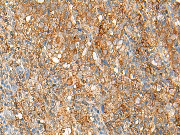 Polyclonal Rabbit anti-Human HLA-DRB1 Antibody (IHC)