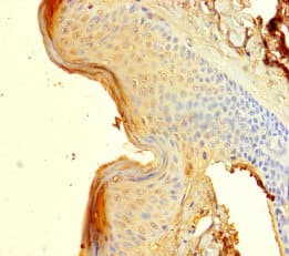 CORNIFIN / SPRR1B Antibody