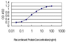 IHC-plus™ CHD4 Antibody (clone 4H4)