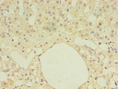 Polyclonal Rabbit anti-Human FDXR Antibody (IHC, WB)