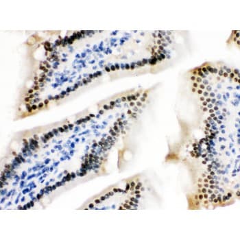 ZBTB7A / Pokemon Antibody (aa125-163)