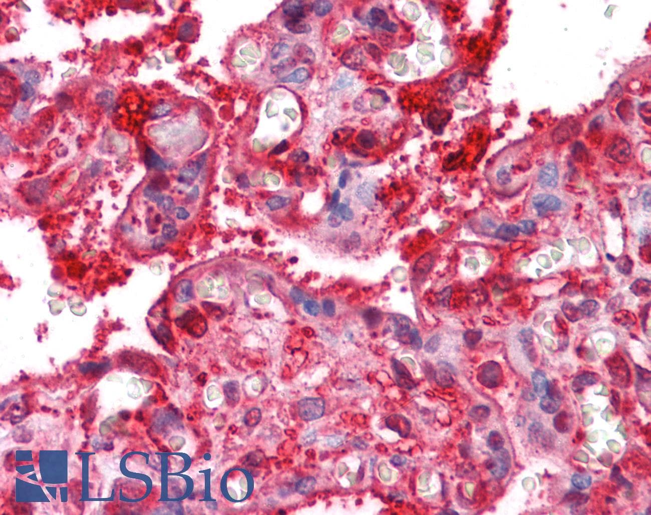 IHC-plus™ RDX / Radixin Antibody (aa537-548)