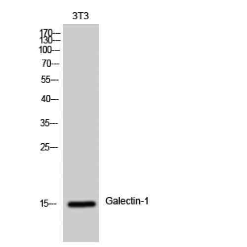 Polyclonal Rabbit anti-Human LGALS1 / Galectin 1 Antibody (10-90 aa, Internal, WB)