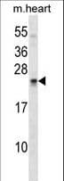 USAG1 / SOSTDC1 Antibody (aa169-196)