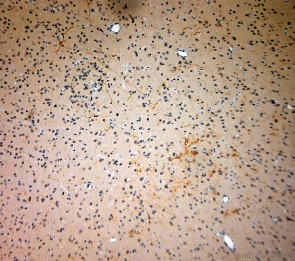 Polyclonal Rabbit anti-Rat SYNPO / Synaptopodin Antibody (aa890-930, IHC)