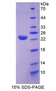 Mouse LIPA / Lysosomal Acid Lipase Protein (Recombinant His-T7)