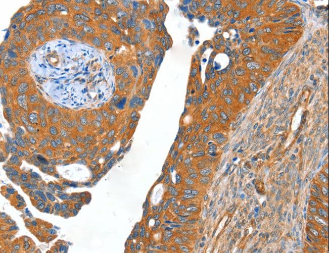 ACOT11 / THEA Antibody