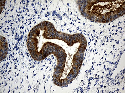 CIB1 / KIP Antibody (aa2-191, clone OTI1B8, Carrier-free)