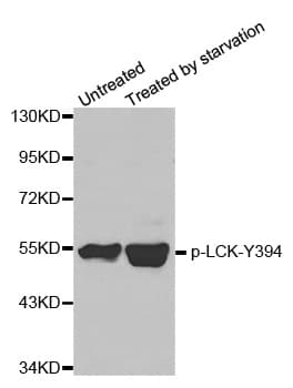 p56lck / LCK Antibody (phospho-Tyr394)
