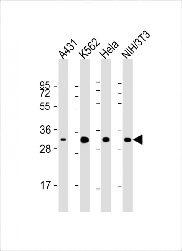 CDK5 Antibody (clone 1552CT262.105.8)