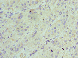 AK2 / Adenylate Kinase 2 Antibody (aa1-232)