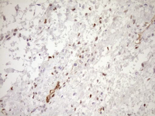 Monoclonal Mouse anti-Human BLNK Antibody (clone OTI4C9, aa1-292, IHC, WB)