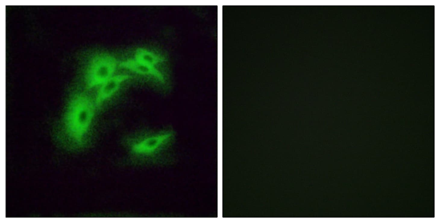 OR5I1 / OR5I Antibody (aa206-255)