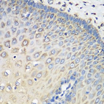 EF1G / EEF1G Antibody