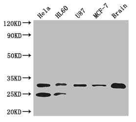 TPI1 / TPI Antibody