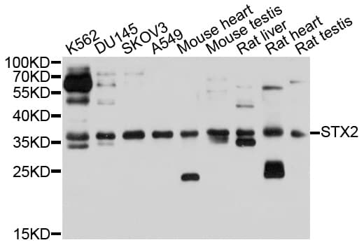 Polyclonal Rabbit anti-Human STX2 / Syntaxin 2 Antibody (WB)
