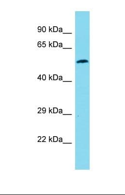 Polyclonal Rabbit anti-Human MTSS1 / MIM Antibody (aa297-345, WB)