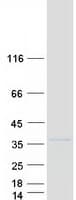 Human CTDSP1 / SCP1 Protein (Recombinant Myc-DDK (Flag))
