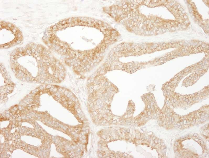 EPS15 Antibody (aa575-625)