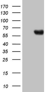 PROZ / Protein Z Antibody (aa115-400, clone OTI1A11)