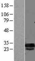 DCUN1D5 Protein (Over-Expression Lysate Myc-DDK (Flag))