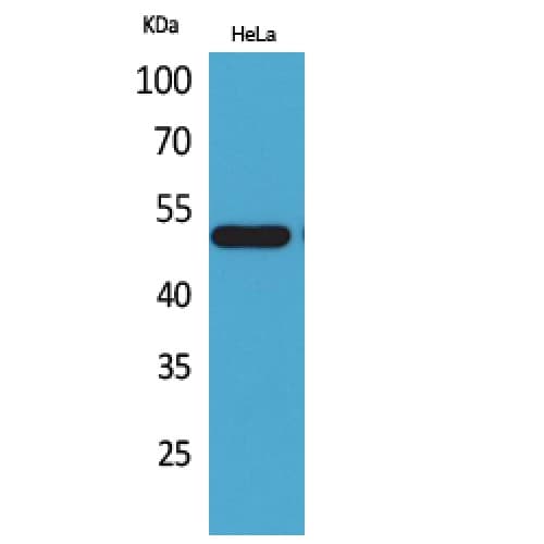 NR1H3 / LXR Alpha Antibody (141-190 aa, Internal)