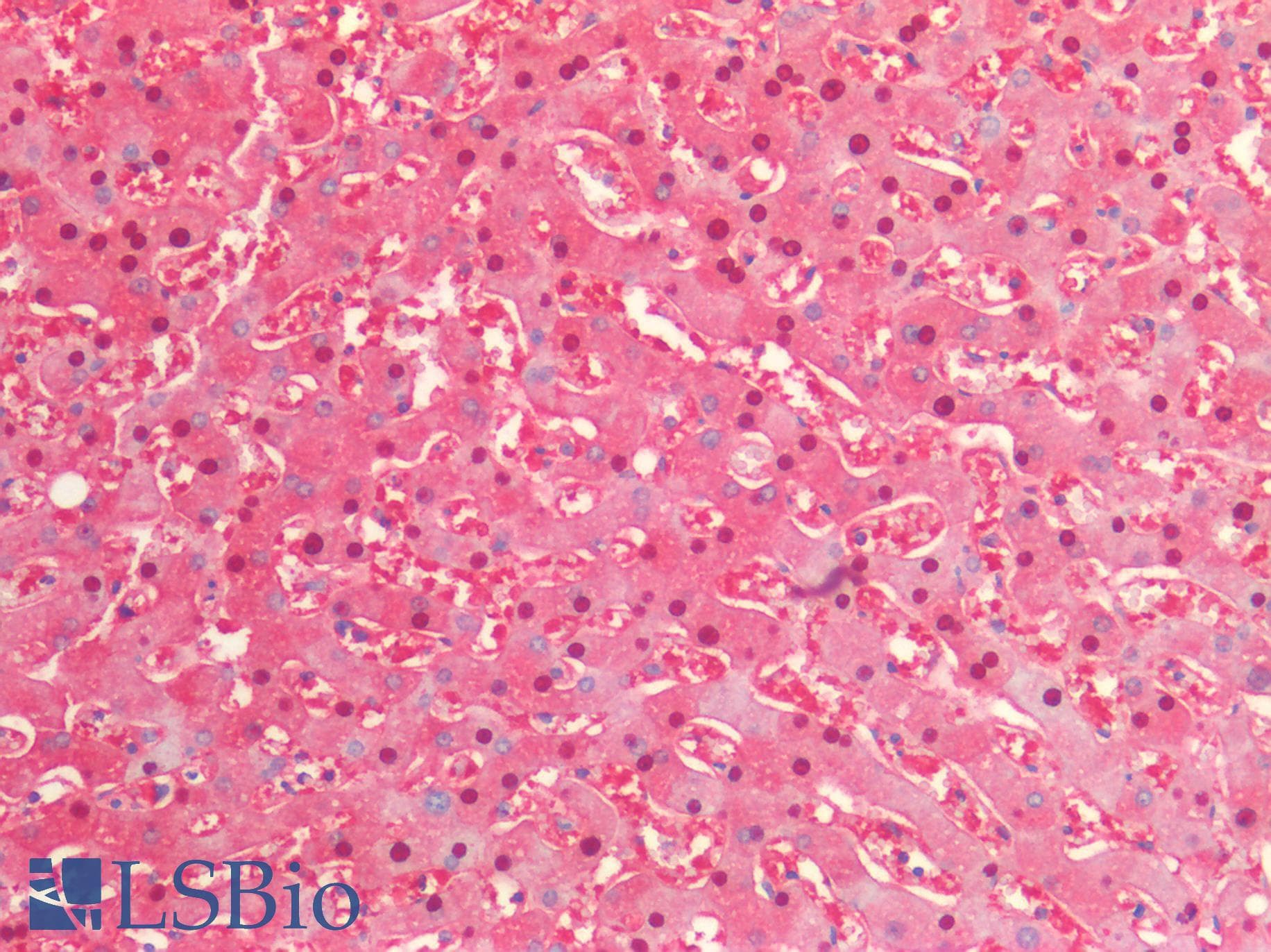 Monoclonal Mouse anti-Human ARG1 / Arginase 1 Antibody (IHC, WB)