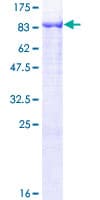 Human GNPAT / DHAP-AT Protein (Recombinant GST)
