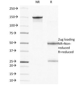 Monoclonal Mouse anti-Human ITGB4 / Integrin Beta 4 Antibody (clone UM-A9, Azide-free,BSA-free, IF)